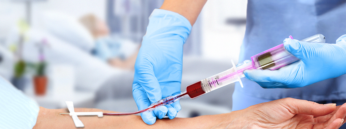 Blood collection being performed on a patient by a ICU VI ByPass Plus Syringe